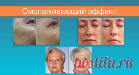 Эффективный, дает потрясающие результаты. Гель позволяет заботиться о нашей коже. Омоложение на лицо, подтяжка, улучшается цвет кожи,  разглаживает морщины, меняет овал лица, меняются люди, которые пользуются этим гелем.