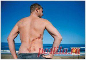 ДЕЛЬФИНЫ СПАСЛИ ЧЕЛОВЕКА.