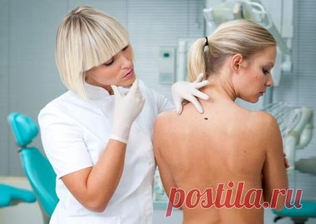 Действенные лекарства с полей и огородов против папиллом - Женский журнал - медиаплатформа МирТесен Папиллома – доброкачественное опухолевидное образование кожи. Имеет вид сосочка на узком основании (ножке), мягкой или плотной консистенции, от светлого до темно-коричневого цвета. Причиной папиллом является вирус папилломы человека (ВПЧ). ВПЧ чрезвычайно заразен. Может передаваться как половым