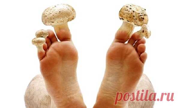 Всего два ингредиента помогут вам забыть о грибке ногтей! - Важное