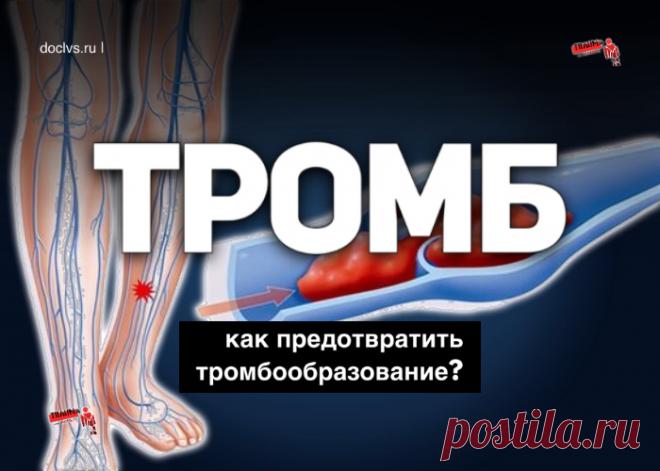 Все знают, что тромбы очень коварны и опасны. От них никто не застрахован. Зачастую смерть от тромбоэмболии возникает внезапно у совершенно здоровых м молодых людей. Что же можно сделать, чтобы уберечь себя от подобной участи?