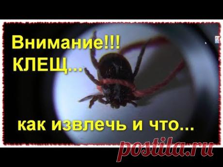 ВНИМАНИЕ КЛЕЩ! Как извлечь и что делать дальше