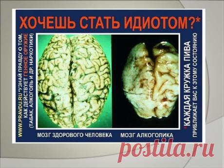 Презентация по теме "Влияние алкоголя на организм человека"