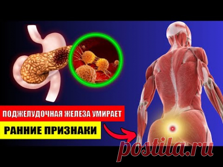 6 СИМПТОМОВ РАКА ПОДЖЕЛУДОЧНОЙ ЖЕЛЕЗЫ, КОТОРЫЕ ВАС ШОКИРУЮТ. КРИТИЧЕСКИЕ ПРЕДУПРЕЖДАЮЩИЕ ПРИЗНАКИ