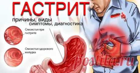 Диабет без диет - Главная