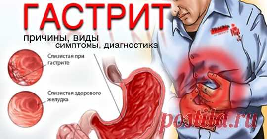 Диабет без диет - Главная