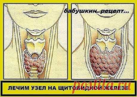 (56) Одноклассники