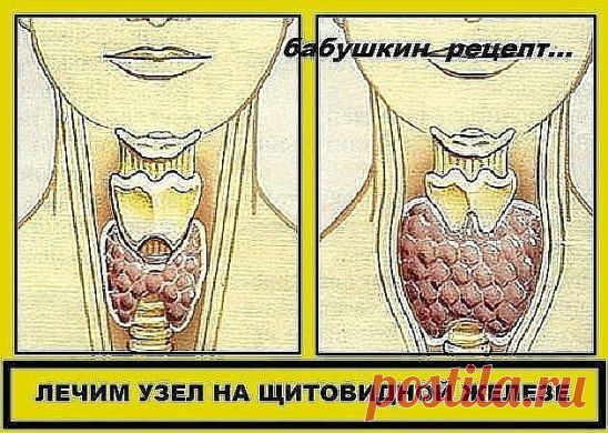 (56) Одноклассники