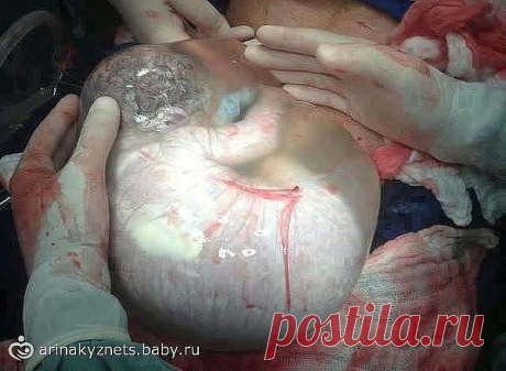ЮЛИЯ Бровко
29 лет, Украина, Запорожье