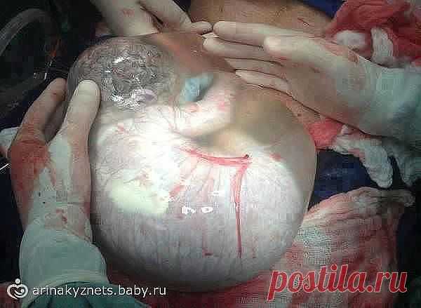 ЮЛИЯ Бровко
29 лет, Украина, Запорожье
