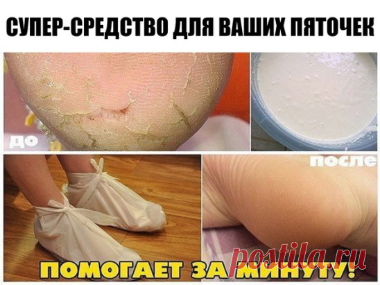 СУПЕР-СРЕДСТВО ДЛЯ ВАШИХ ПЯТОЧЕК! ПОМОГАЕТ ЗА МИНУТУ! 
И так..... Берём небольшую мисочку (такого размера, чтобы только поместились в неё ноги), наливаем 1,5 литра воды , чтобы была горяченькая, но не очень. Добавляем в воду 4 столовых ложки перекиси водорода. Ставим ноги в воду и сидим. Уже через несколько минут создаётся такое впечатление, что вы парили ноги по крайней мере полчаса. Если подошвы очень запущены, посидите подольше . Вы сами почувствуете эффект, когда потрёте нога об ногу, как о
