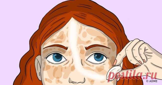 10 средств для кожи, которые стирают пигментные пятна как ластик