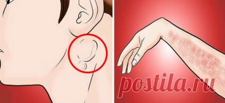 15 предупреждающих симптомов рака, которые обычно игнорируются
Вы должны это знать!
Если у вас есть семейная история рака, тогда вы должны быть очень внимательны, особенно если вы видите признаки, которые странны для вашего тела.Многие люди все еще …