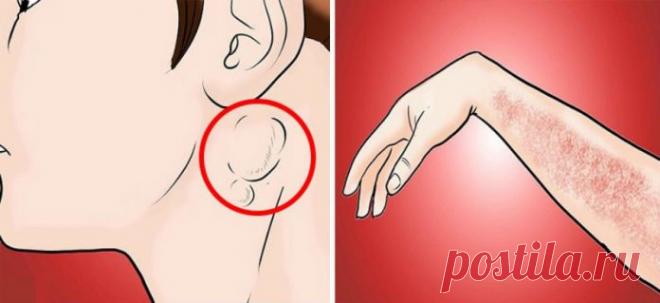 15 предупреждающих симптомов рака, которые обычно игнорируются 


Вы должны это знать!







 


Если у вас есть семейная история рака, тогда вы должны быть очень внимательны, особенно если вы видите признаки, которые странны для вашего тела.Многие люди все еще …