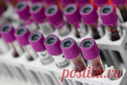 Россиянам рассказали о необходимых после перенесения COVID-19 анализах. Гендиректор центра молекулярно-генетических исследований ДНКОМ Андрей Исаев рассказал, что после перенесенного COVID-19 россиянам следует сдать анализы на гемостаз и проверить скорость распада тромбов и пройти биохимические скрининги. Это, по его мнению, поможет предупредить тяжелые последствия.