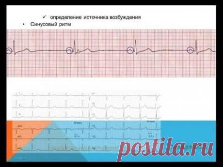 Видеокурс ЭКГ для начинающих
