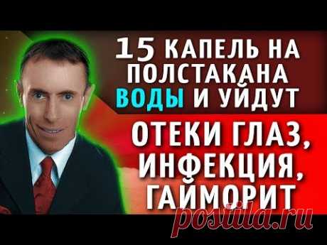 15 КАПЕЛЬ НА ПОЛСТАКАНА ВОДЫ И УЙДУТ ОТЕКИ ГЛАЗ, ИНФЕКЦИЯ, ГАЙМОРИТ! Гланды главный страж иммунитета