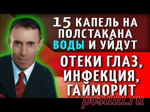 15 КАПЕЛЬ НА ПОЛСТАКАНА ВОДЫ И УЙДУТ ОТЕКИ ГЛАЗ, ИНФЕКЦИЯ, ГАЙМОРИТ! Гланды главный страж иммунитета