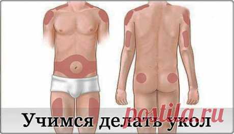 Как сделать правильно укол внутримышечно