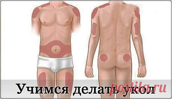 Как сделать правильно укол внутримышечно