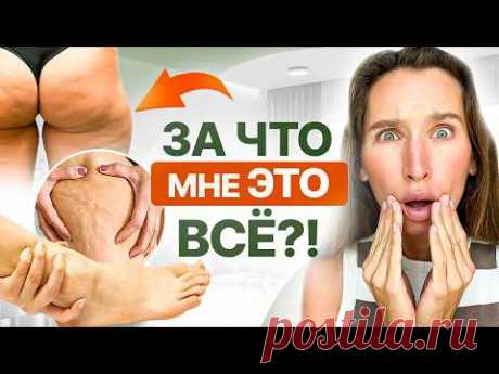Ушки на бедрах, жирные ляжки, целлюлит, галифе, отеки ног, валики над коленями: как всё ЭТО убрать?