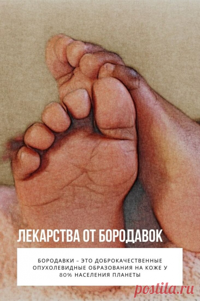 Лекарства от бородавок. Бородавки – это доброкачественные опухолевидные образования на коже у 80% населения планеты. Возникают в результате влияния ВПЧ. Возбудитель попадает в организм человека, активизируется при снижении иммунитета: хронических, простудных заболеваниях, беременности, других неблагоприятных факторах. Лекарство от бородавок зависит от их характерных особенностей.
