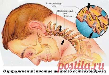 Простые восемь упражнений при шейном остеохондрозе