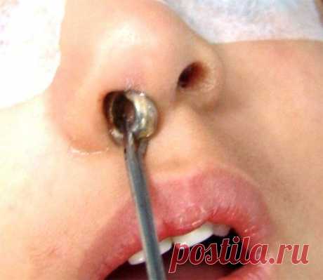 Что делать, если ребёнок засунул в нос мелкий предмет | Выживи сам