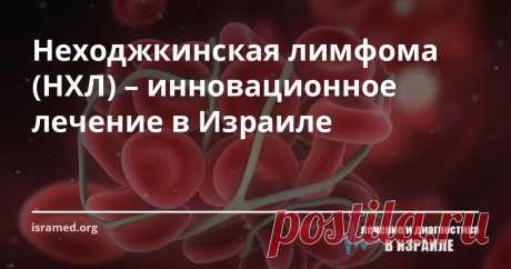 Неходжкинская лимфома (НХЛ) – инновационное лечение в Израиле В нашей клинике установлено ультрасовременное оборудование, аналогов которому нет даже в Европе и США. Принимая решение лечиться в Израиле, вы значительно повышаете свои шансы на то, что прогрессирование заболевания будет вовремя приостановлено и врачи сделают всё, чтобы добиться регресса.