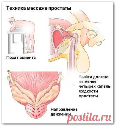 Лечебный массаж для мужчин - массаж простаты (обучающее видео)