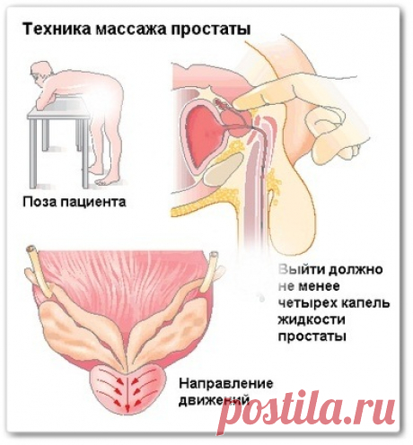 Массаж простаты (обучающее видео)