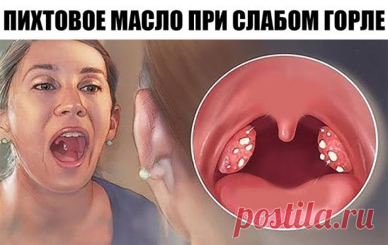 У вас часто болит горло, пропадает голос и мучает кашель? Вот как избавиться от этих проблем за ночь, просто и легко!
Каждую весну и осень у меня воспалялось горло, пропадал голос и мучил кашель, пока одна старая медсестра не дала мне совет.
Поможет при слабом горле пихтовое масло.
Эфирное пихтовое масло с незапамятных времен известно своими целебными качествами, но и в наши дни не утратило сво