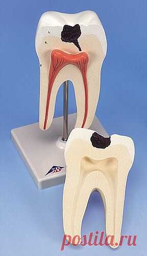 КАРИЕС: ПРОФИЛАКТИКА И ЛЕЧЕНИЕ ЛЕКАРСТВЕННЫМИ ТРАВАМИ...