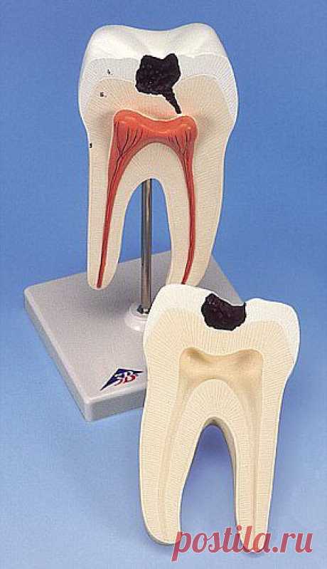 КАРИЕС: ПРОФИЛАКТИКА И ЛЕЧЕНИЕ ЛЕКАРСТВЕННЫМИ ТРАВАМИ...