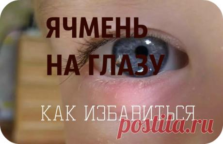 ДОМАШНИЙ СПОСОБ БЫСТРОГО ЛЕЧЕНИЯ ЯЧМЕНЯ НА ГЛАЗУ