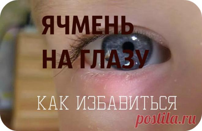 ДОМАШНИЙ СПОСОБ БЫСТРОГО ЛЕЧЕНИЯ ЯЧМЕНЯ НА ГЛАЗУ