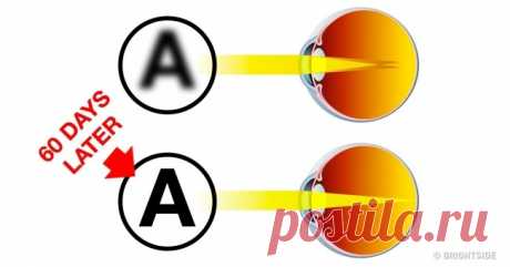 10 Simple and Relaxing Exercises for Your Eyes