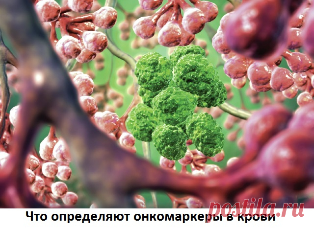 Онкомаркеры что это такое, насколько им можно доверять - Сайт о методах лечения докторов Неумывакина, Болотова, Огулова. Лечение нетрадиционными методами(фитотерапия, апитерапия, перекись, сода и другое) На сегодняшний день онкология является одним из самых распространенных и опасных заболеваний. Современная медицина направляет множество усилий на диагностику и терапию раковых болезней. Одним из наиболее эффективных методов обследования считается анализ на онкомаркер, что ...