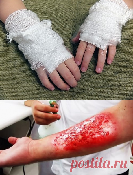 (35) Одноклассники