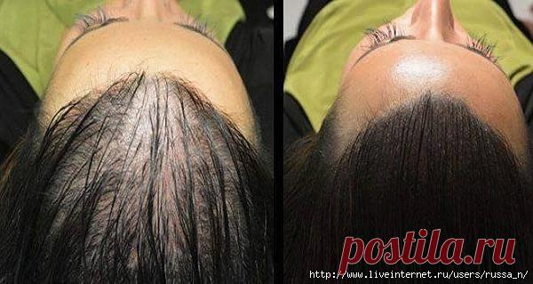 Волшебный рецепт для быстрого роста волос!