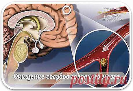 (67) Одноклассники