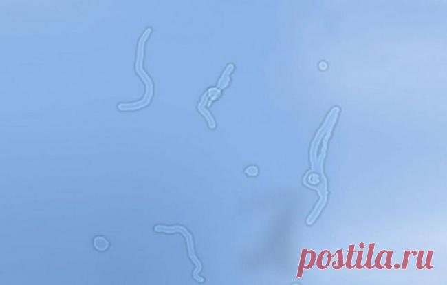 Откуда берутся эти прозрачные штуки, плавающие перед глазами