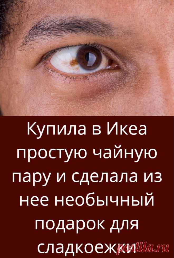 Опухоли глазницы: доброкачественные и злокачественные