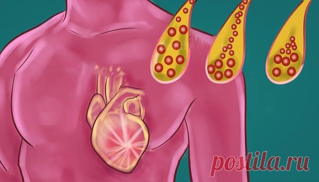 Подумай: Продукты, которые вы должны ежедневно потреблять для очистки артерий