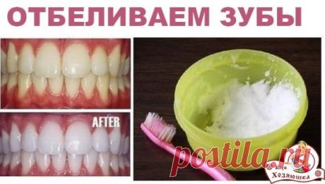 ОТБЕЛИВАЕМ ЗУБЫ
Выдавите немного зубной пасты в небольшую емкость, добавьте:
- 1 ч.л. пищевой соды,
- 1 ч.л. перекиси водорода
- 0,5 ч.л. воды.
Тщательно смешайте ингредиенты и нанесите на зубную щетку, чистите зубы 2 минуты 1 раз в неделю. Использовать данный рецепт можно несколько раз в год, по 1-1,5 месяца, затем нужно делать перерыв.
★★★★★★★★★★★★★★★★★★★★★★★★★★★★★★★★★★★★★★★★★★★
 ПРИСОЕДИНЯЙТЕСЬ в нашу группу, у нас много домашних &quot;хитростей&quot;  
  •••• https://ok.ru/hoz.hi...