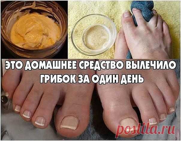 ЭТО ДОМАШНЕЕ СРЕДСТВО ВЫЛЕЧИЛО ГРИБОК ЗА ОДИН ДЕНЬ
Прекрасно помогает и такое старинное народное средство: возьмите свежее куриное яйцо и положите в стакан так, чтобы оно не соприкасалось со стенками, и вливайте уксусную эссенцию, пока она полностью не покроет яйцо. Поставьте в темное место и дайте постоять до полного растворения скорлупы. Потом снимите с яйца оставшуюся пленку и выкиньте ее. Добавьте в смесь (эссенции с яйцом) чайную ложку сливочного масла и разотрите до ...