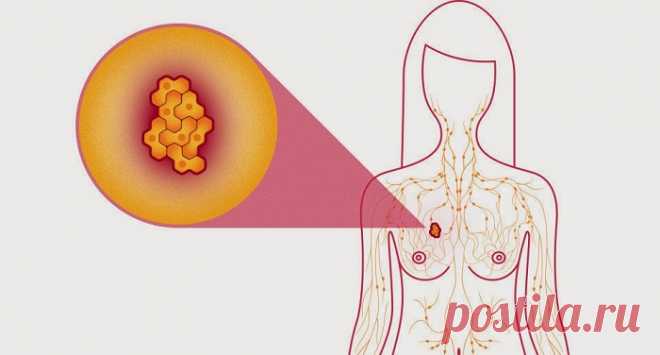 Ученые обнаружили: эти 2 ингредиента излечат даже рак молочной железы! - Стильные советы