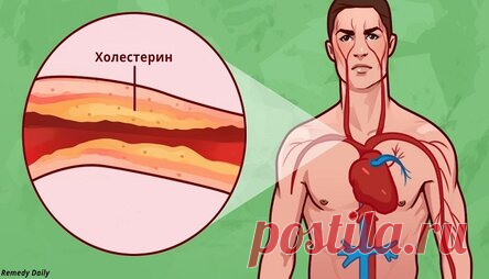 8 способов борьбы с холестерином и гипертонией