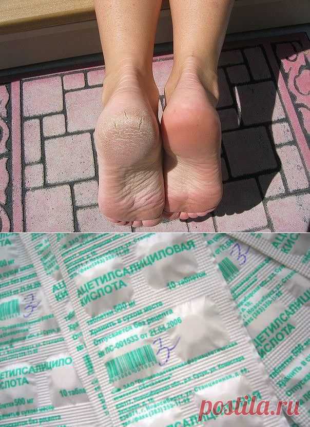 Пяточки