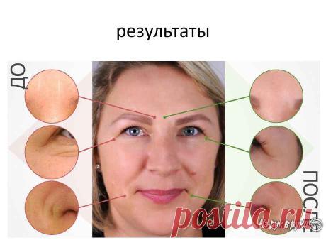 Косметика VISION Skincare: вечная молодость, по выгодным ценам, Самарская обл, Тольятти. Цена 11 667 руб. - ИЗ РУК В РУКИ
